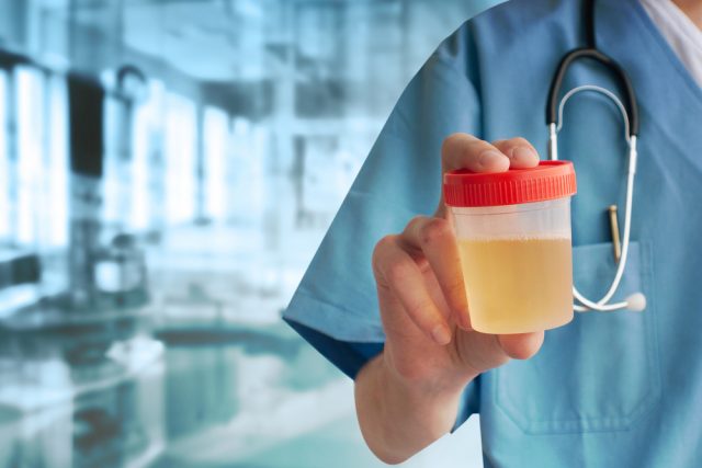 Warna-Urine-dan-Artinya-Bagi-Kesehatan-Kamu.jpg